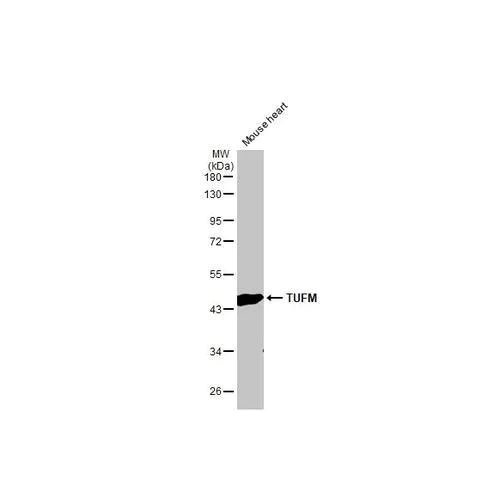 Western blot - Anti-TUFM antibody [HL2117] (AB317138)