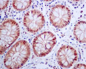 Immunohistochemistry (Formalin/PFA-fixed paraffin-embedded sections) - Anti-TUG antibody [EPR8615] - BSA and Azide free (AB248385)