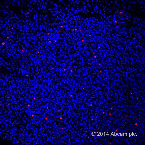 Fluorescence Microscopy - TUNEL Assay Kit - BrdU-Red (AB66110)