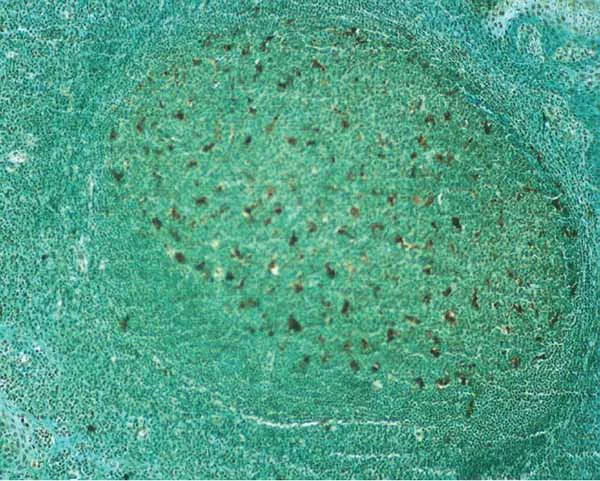 Immunocytochemistry - TUNEL Assay Kit - HRP-DAB (AB206386)