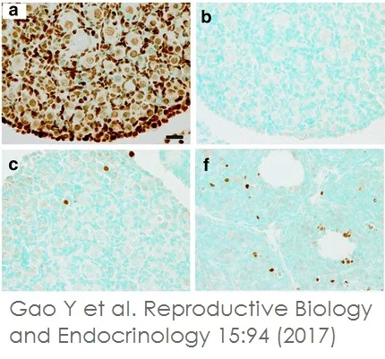 Immunohistochemistry - TUNEL Assay Kit - HRP-DAB (AB206386)