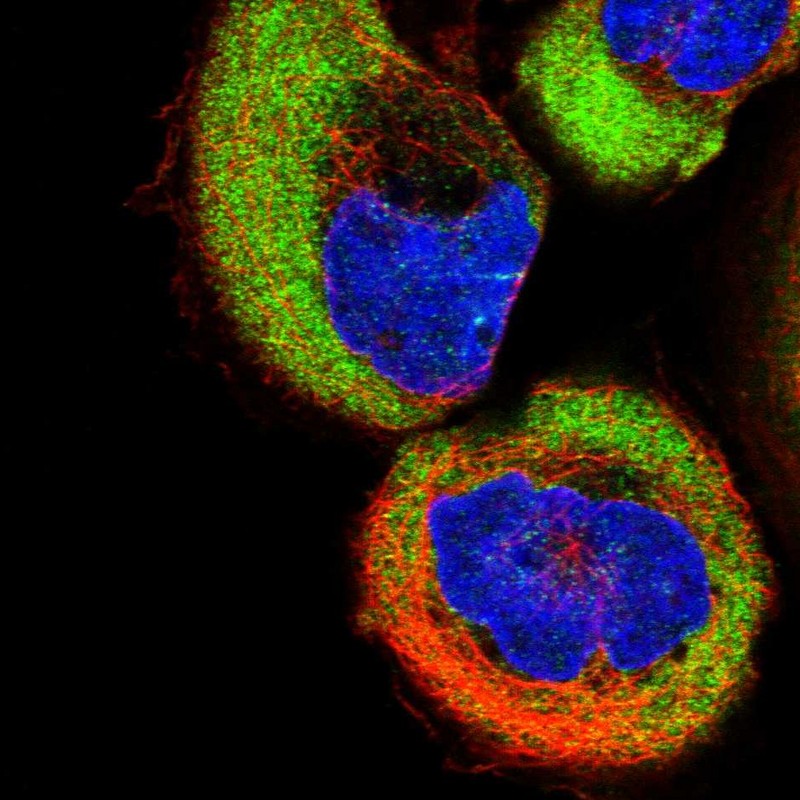 Immunocytochemistry/ Immunofluorescence - Anti-TUSC2/FUS1 antibody (AB246970)