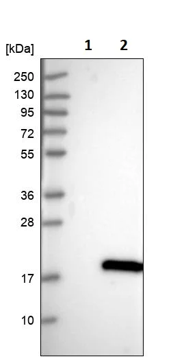 Western blot - Anti-TUSC2/FUS1 antibody (AB246970)