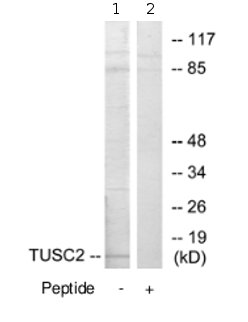 Western blot - Anti-TUSC2/FUS1 antibody (AB70182), expandable thumbnail