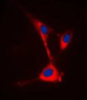 Immunocytochemistry/ Immunofluorescence - Anti-TUSC3 antibody (AB230520)
