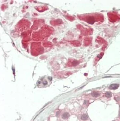 Immunohistochemistry (Formalin/PFA-fixed paraffin-embedded sections) - Anti-TUSC3 antibody (AB230520)
