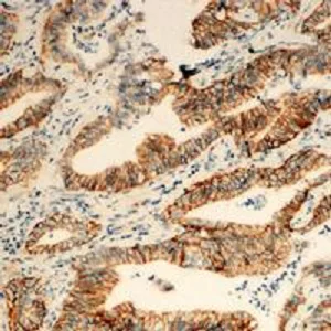 Immunohistochemistry (Formalin/PFA-fixed paraffin-embedded sections) - Anti-TUSC3 antibody (AB230520)
