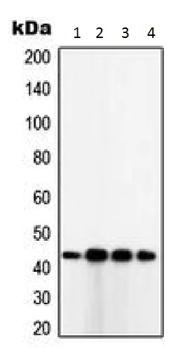Western blot - Anti-TUSC3 antibody (AB230520)