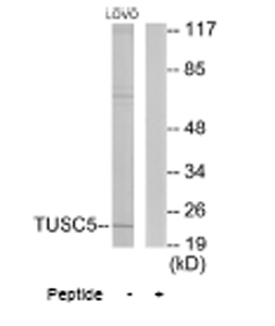 Western blot - Anti-TUSC5 antibody (AB64803), expandable thumbnail