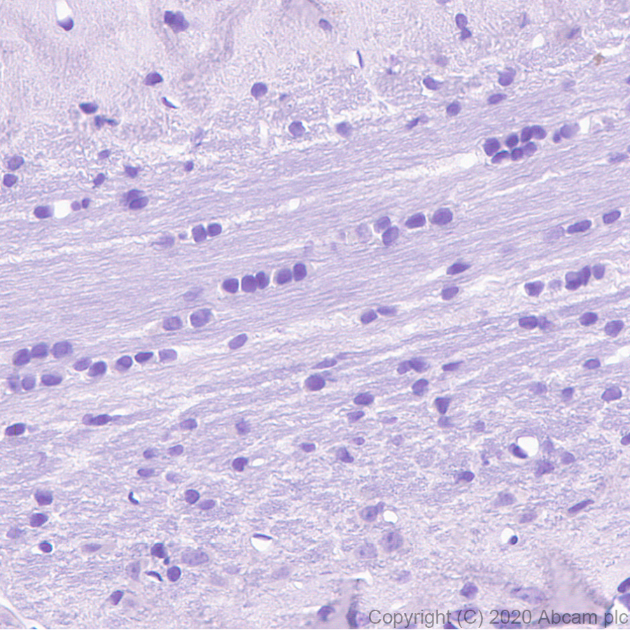 Immunohistochemistry (Formalin/PFA-fixed paraffin-embedded sections) - Anti-TVA antibody [PICA187E] - BSA and Azide free (ab271302), expandable thumbnail