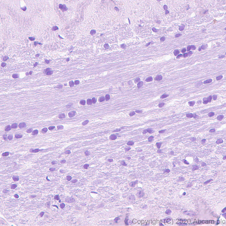 Immunohistochemistry (Formalin/PFA-fixed paraffin-embedded sections) - Anti-TVA antibody [PICA187E] - BSA and Azide free (AB271302)