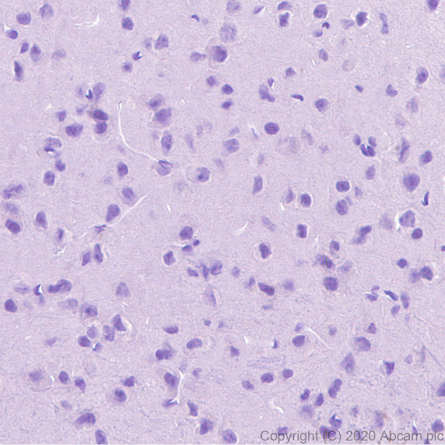Immunohistochemistry (Formalin/PFA-fixed paraffin-embedded sections) - Anti-TVA antibody [PICA187E] - BSA and Azide free (ab271302), expandable thumbnail