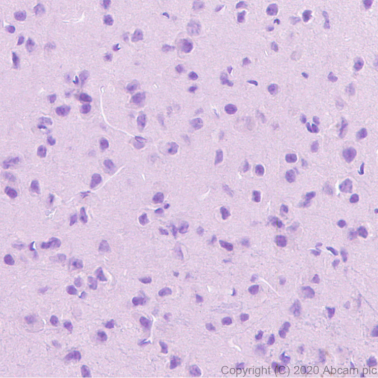 Immunohistochemistry (Formalin/PFA-fixed paraffin-embedded sections) - Anti-TVA antibody [PICA187E] - BSA and Azide free (AB271302)