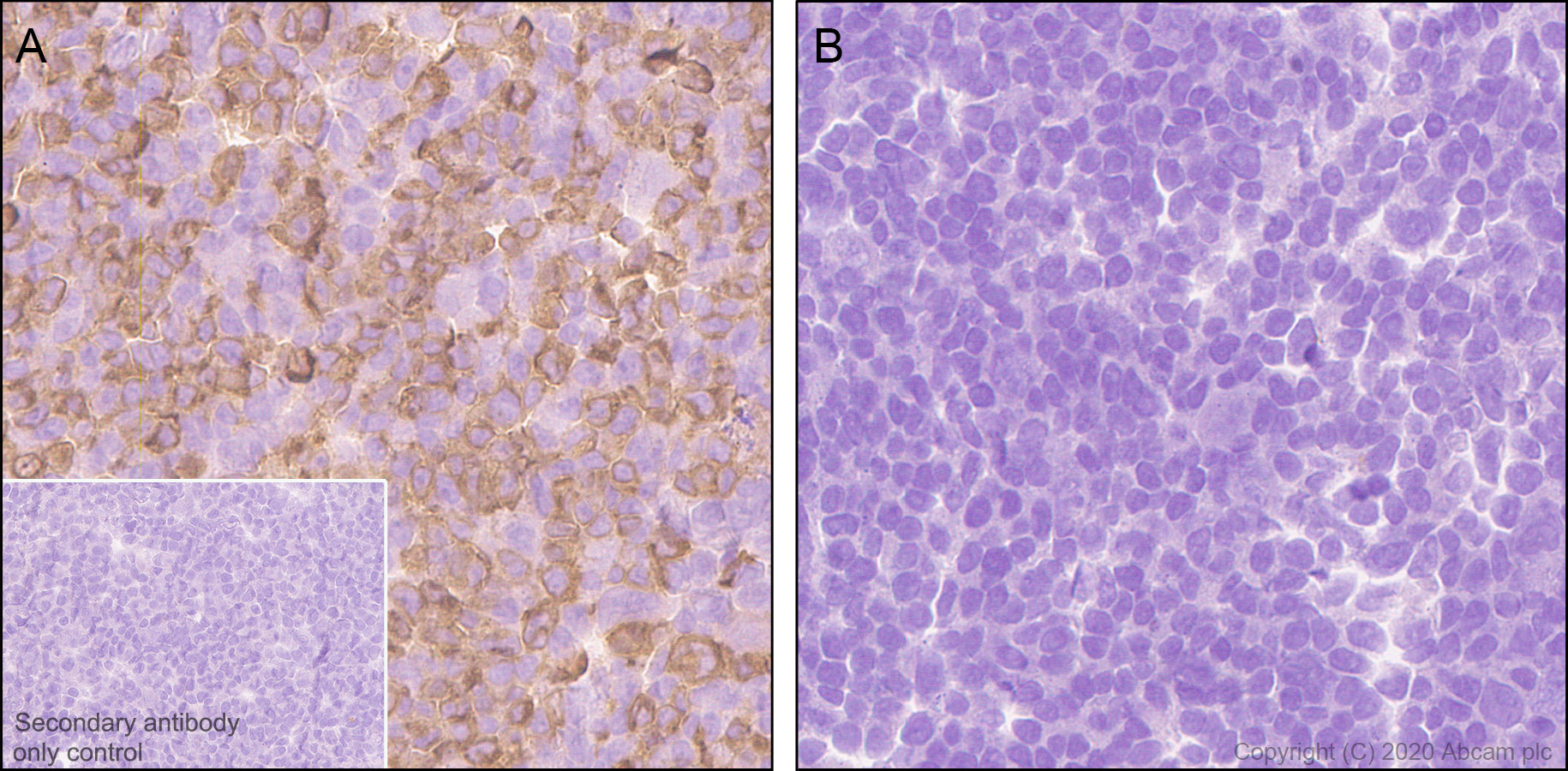 Immunohistochemistry (Formalin/PFA-fixed paraffin-embedded sections) - Anti-TVA antibody [PICA187E] - BSA and Azide free (AB271302), expandable thumbnail