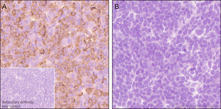 Immunohistochemistry (Formalin/PFA-fixed paraffin-embedded sections) - Anti-TVA antibody [PICA187E] - BSA and Azide free (AB271302)