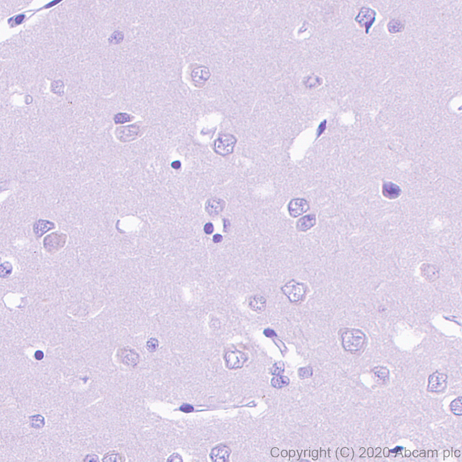 Immunohistochemistry (Formalin/PFA-fixed paraffin-embedded sections) - Anti-TVA antibody [PICA187E] - BSA and Azide free (AB271302), expandable thumbnail