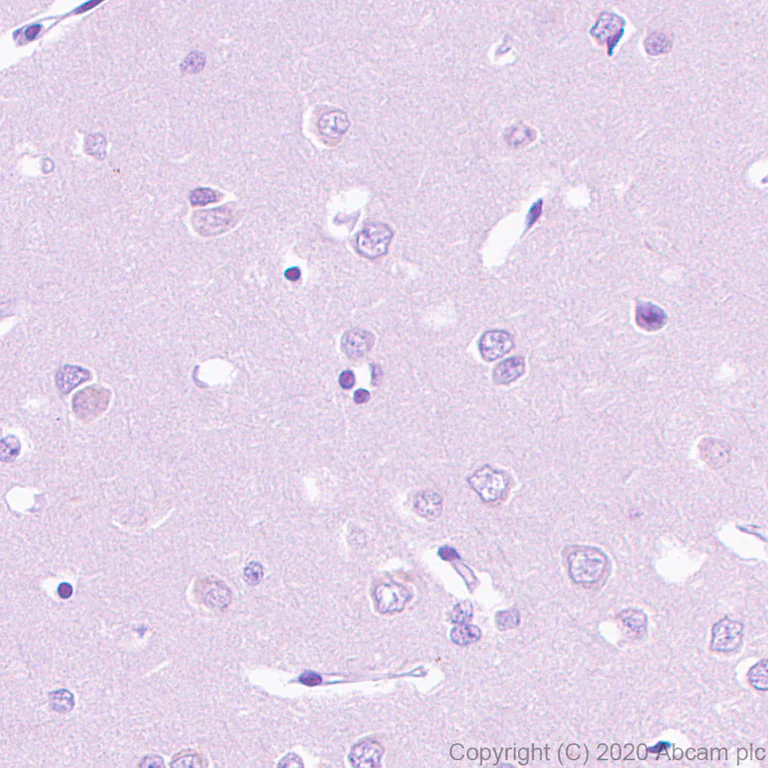 Immunohistochemistry (Formalin/PFA-fixed paraffin-embedded sections) - Anti-TVA antibody [PICA187E] - BSA and Azide free (AB271302)