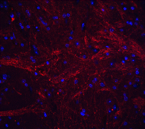 Immunohistochemistry (Formalin/PFA-fixed paraffin-embedded sections) - Anti-TWEAK antibody (AB37170), expandable thumbnail