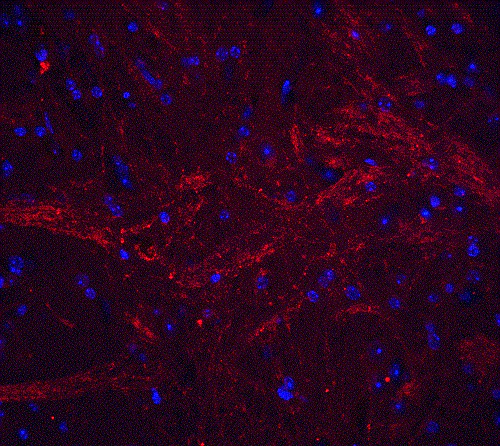 Immunohistochemistry (Formalin/PFA-fixed paraffin-embedded sections) - Anti-TWEAK antibody (AB37170)