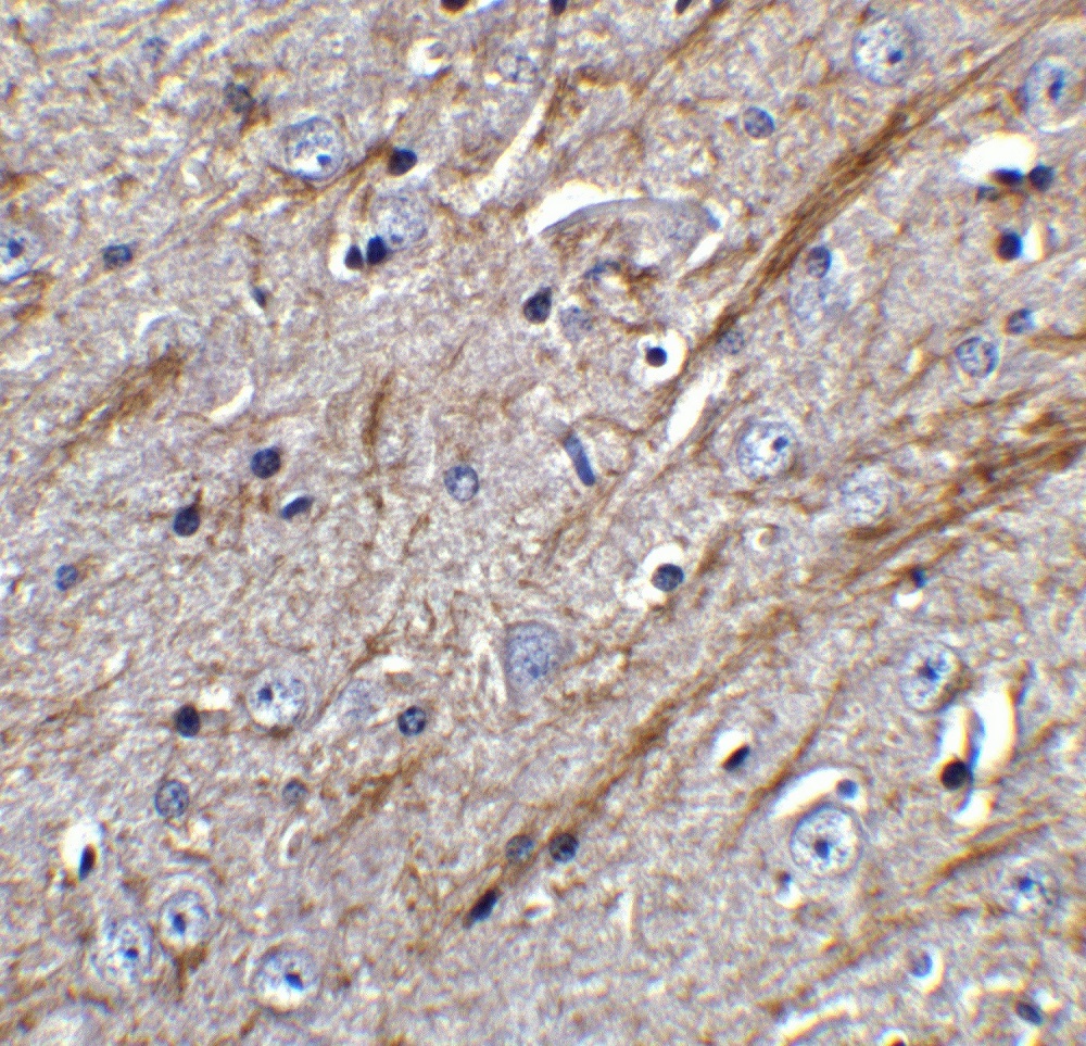 Immunohistochemistry (Formalin/PFA-fixed paraffin-embedded sections) - Anti-TWEAK antibody (AB37170), expandable thumbnail