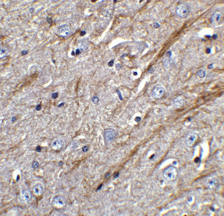 Immunohistochemistry (Formalin/PFA-fixed paraffin-embedded sections) - Anti-TWEAK antibody (AB37170)