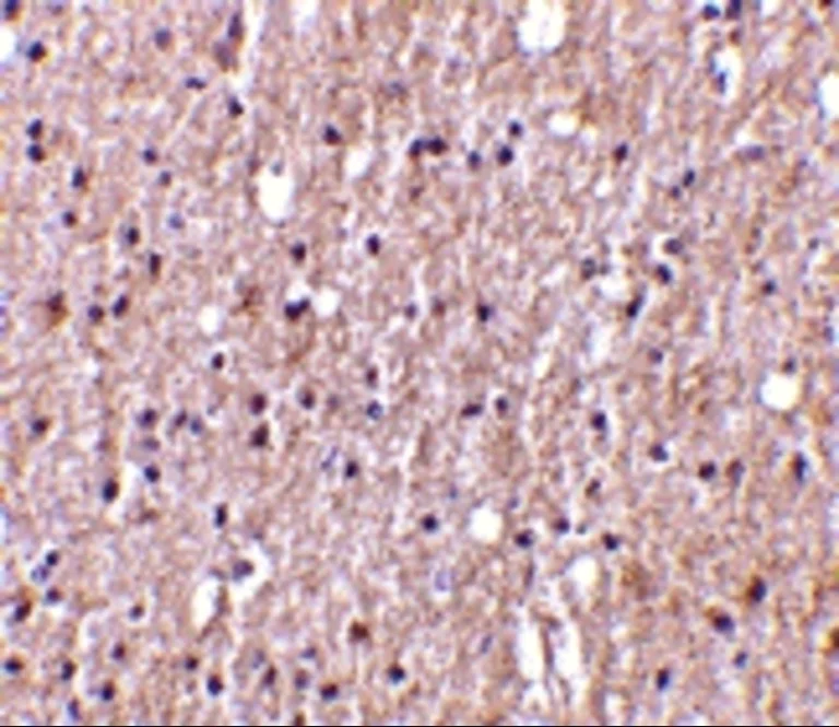 Immunohistochemistry (Formalin/PFA-fixed paraffin-embedded sections) - Anti-TWEAK antibody (AB37170)