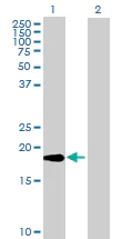 Western blot - TWEAK overexpression 293T lysate (whole cell) (AB94113)