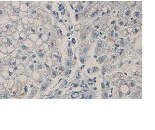 Immunohistochemistry (Formalin/PFA-fixed paraffin-embedded sections) - Anti-TWEAKR/FN14 antibody (AB85089)