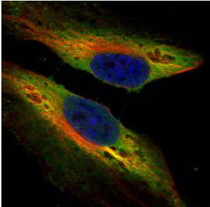 Immunocytochemistry/ Immunofluorescence - Anti-TWF1/Twinfilin-1 antibody (AB154725)