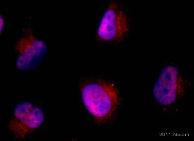 Immunocytochemistry/ Immunofluorescence - Anti-Twist antibody (AB50581)