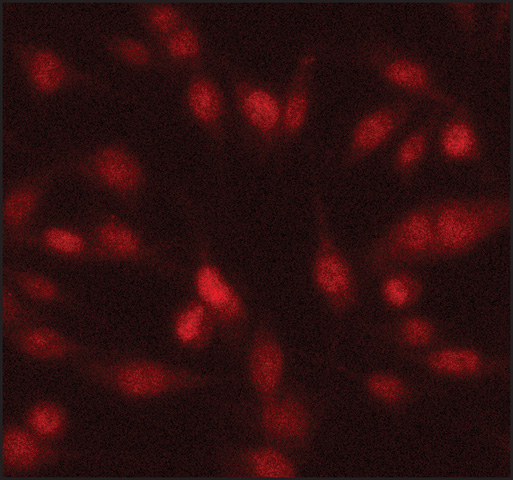 Immunocytochemistry/ Immunofluorescence - Anti-Twist antibody (AB50581), expandable thumbnail