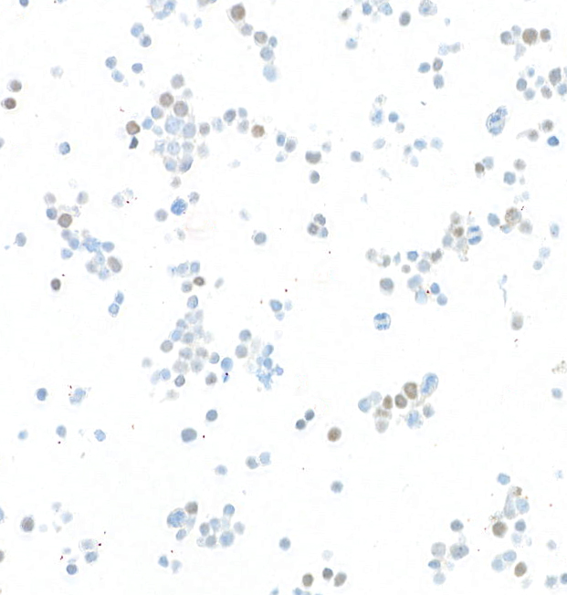 Immunocytochemistry - Anti-TWIST antibody [BLR156J] - BSA free (AB314056), expandable thumbnail