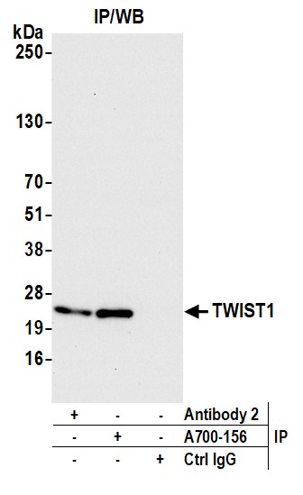 Immunoprecipitation - Anti-TWIST antibody [BLR156J] - BSA free (AB314056), expandable thumbnail