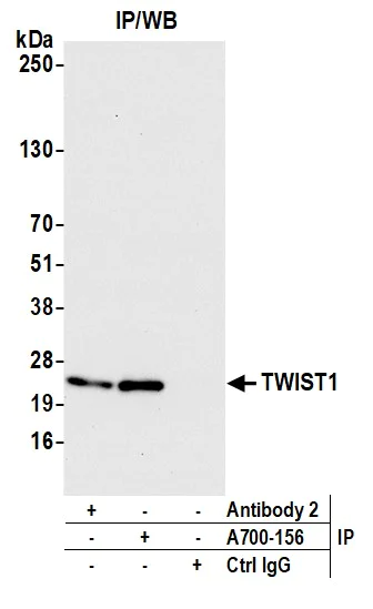 Immunoprecipitation - Anti-TWIST antibody [BLR156J] - BSA free (AB314056)