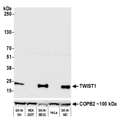 Western blot - Anti-TWIST antibody [BLR156J] - BSA free (AB314056), expandable thumbnail