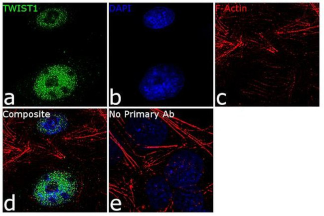 Immunocytochemistry/ Immunofluorescence - Anti-Twist Antibody [RP23040206] (AB313483), expandable thumbnail