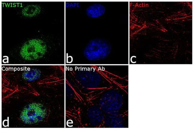 Immunocytochemistry/ Immunofluorescence - Anti-Twist antibody [RP23040206] (AB313483)