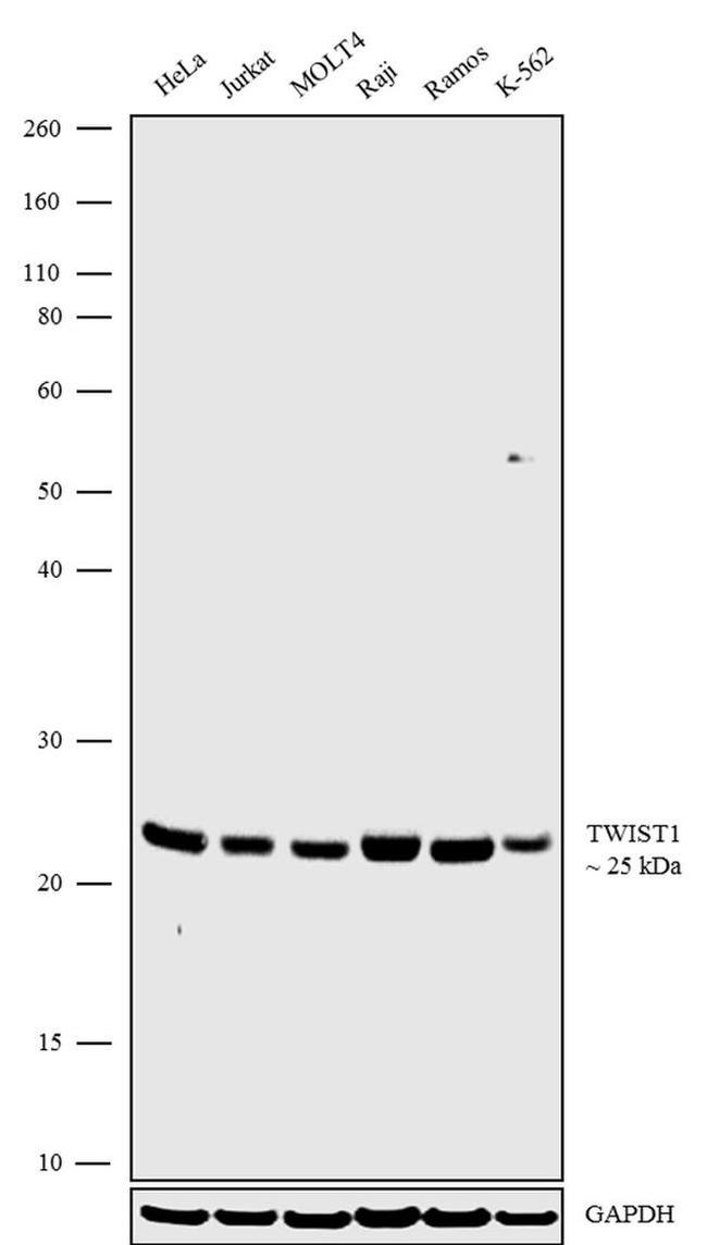 Western blot - Anti-Twist Antibody [RP23040206] (AB313483), expandable thumbnail