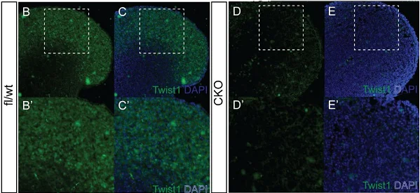 Immunocytochemistry - Anti-Twist antibody [Twist2C1a] (AB50887)