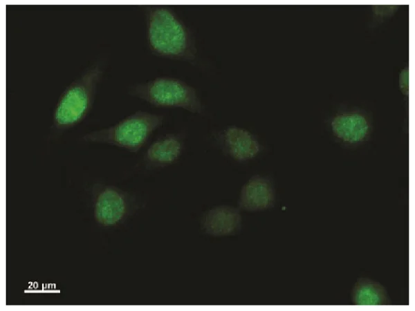 Immunocytochemistry - Anti-Twist antibody [Twist2C1a] (AB50887)