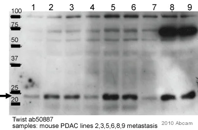 Western blot - Anti-Twist antibody [Twist2C1a] (AB50887)