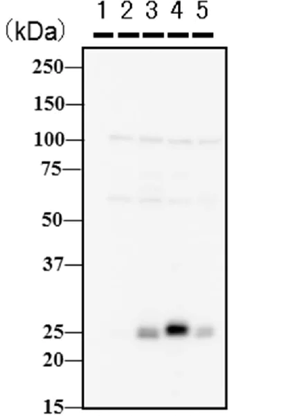 Western blot - Anti-Twist antibody [Twist2C1a] (AB50887)