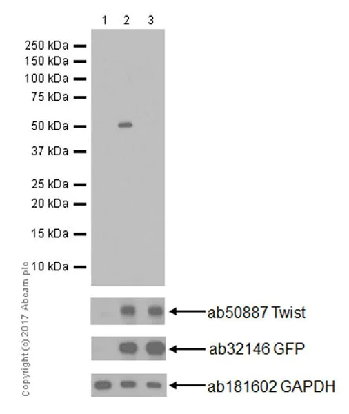 Western blot - Anti-Twist (phospho S68) antibody [EP18178] (AB187008)