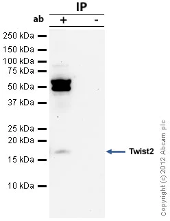 Immunoprecipitation - Anti-Twist2 antibody (AB66031)