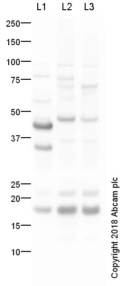 Western blot - Anti-Twist2 antibody (AB66031)