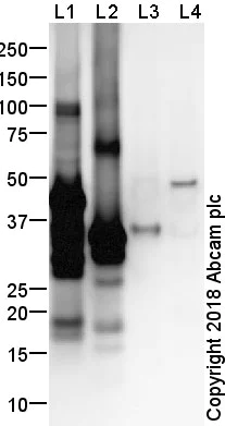 Western blot - Anti-Twist2 antibody (AB66031)