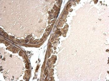 Immunohistochemistry (Formalin/PFA-fixed paraffin-embedded sections) - Anti-TWSG1/TSG antibody (AB183890)