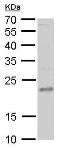 Western blot - Anti-TWSG1/TSG antibody (AB183890)