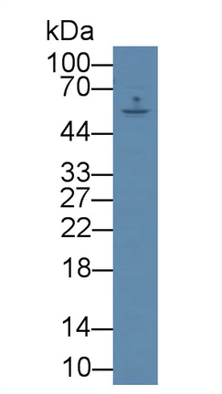 Western blot - Anti-TXK/RLK antibody (AB233260)