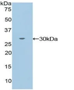 Western blot - Anti-TXK/RLK antibody (AB233260)